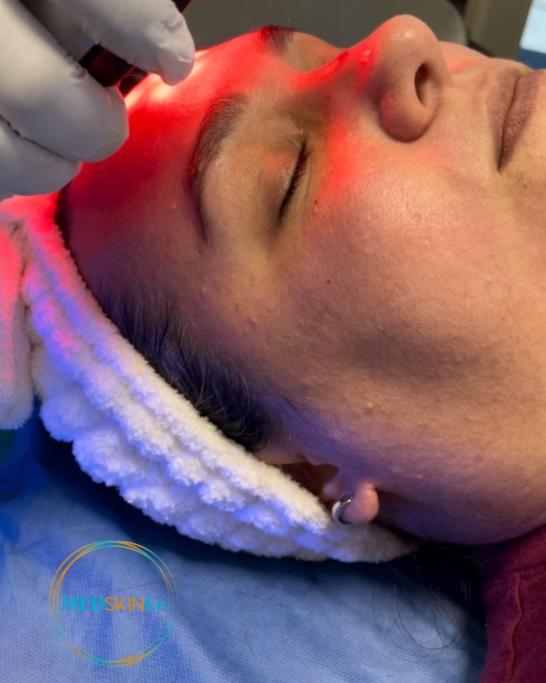 Medskinco Luz Led